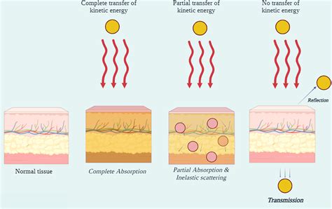 How Do Clinicians Prescribe Photobiomodulation Therapy PBMT