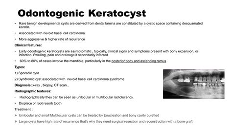 Classification And Management Odontogenic Cysts Of Oral Cavity PPT