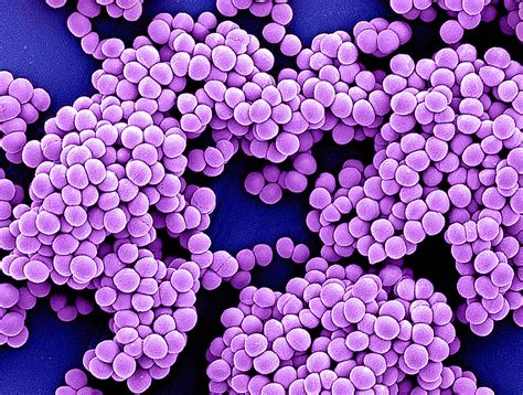 Methicillin Resistant Staphylococcus Aureus Mrsa Bacteri Flickr