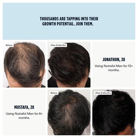 Nutrafol Men Hair Growth Supplement Clinically Proven For Thicker Hair 1 Month Supply