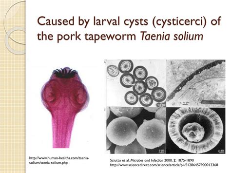 Ppt Neurocysticercosis Cysticercosis Powerpoint Presentation