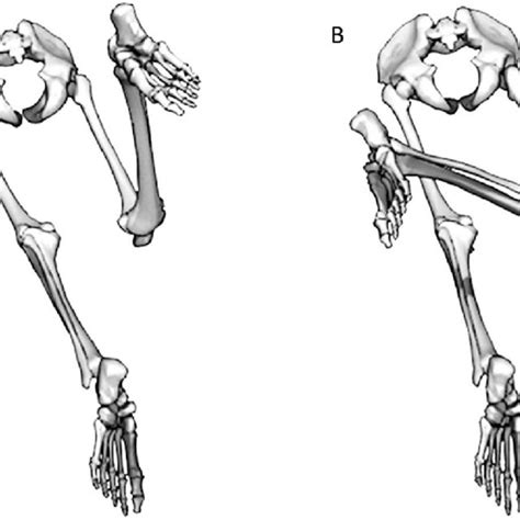 Clinical Measures Of The Lumbopelvic Control Impairment In The Sagittal