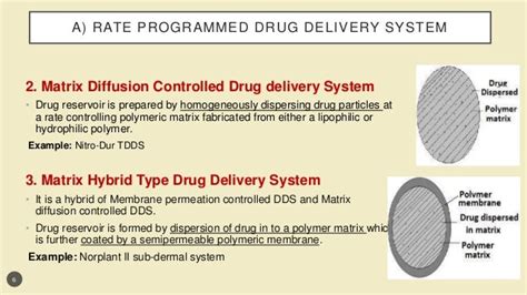 Implantable Drug Delivery System