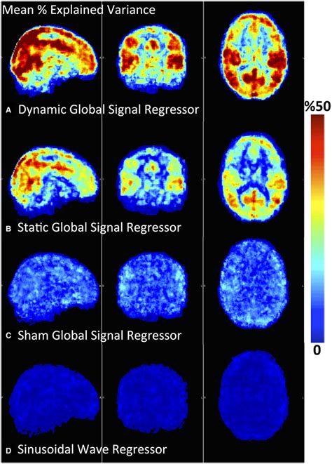 Frontiers Correcting For Blood Arrival Time In Global Mean Regression