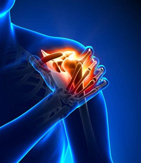 Cirurgia De Latarjet Em Que Consiste E Para Que Está Indicada Atlas