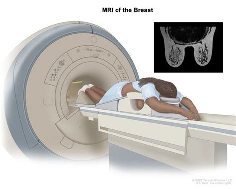 Definition Of Magnetic Resonance Imaging Nci Dictionary Of Cancer Terms Nci