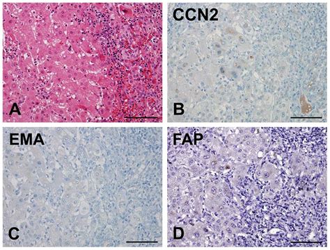 Connective Tissue Growth Factor Ccn Epithelial Membrane Antigen