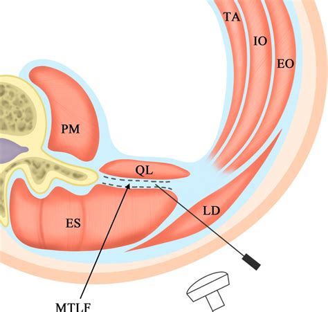 Quadratus Lumborum Muscle Cross Section