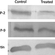 Western Blot Analysis Of MMP 9 And MMP 2 In Caudal Fins Of Control And