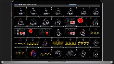 Pacs Unpacked Guide To The 12 Best Pacs Software In 2024 The Medical Practice