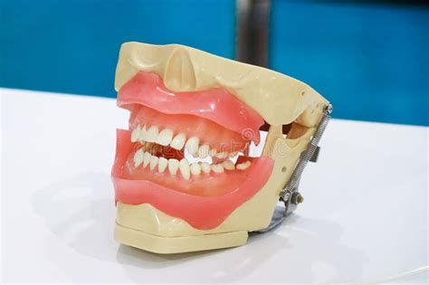 Jaw Teeth Or Human Jaw Model With A View Of Teeth Prosthetic Model For