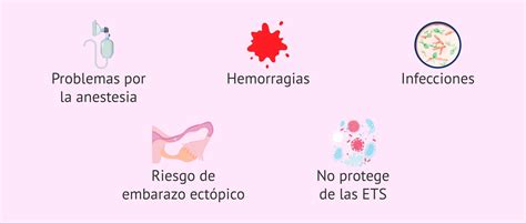 Ligadura De Trompas Ventajas Desventajas Y Todo Lo Que Debes Saber