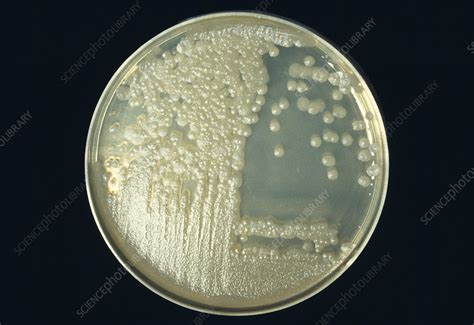 Cultured Anthrax Bacteria Stock Image M8740538 Science Photo Library