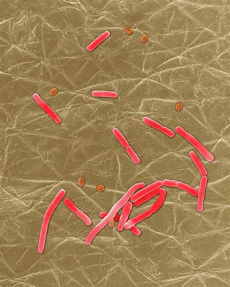 Bacillus Anthracis Photograph By Dennis Kunkel Microscopy Science Photo