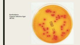 Burkholderia Cepacia PPT