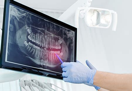 Dental Xrays Near Me - Dental X-Rays - Dental X-Rays Near Me - Garden Ridge Dentistry