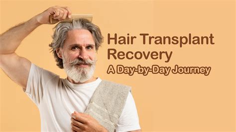 Hair Transplant Recovery | Health Tourism In Iran