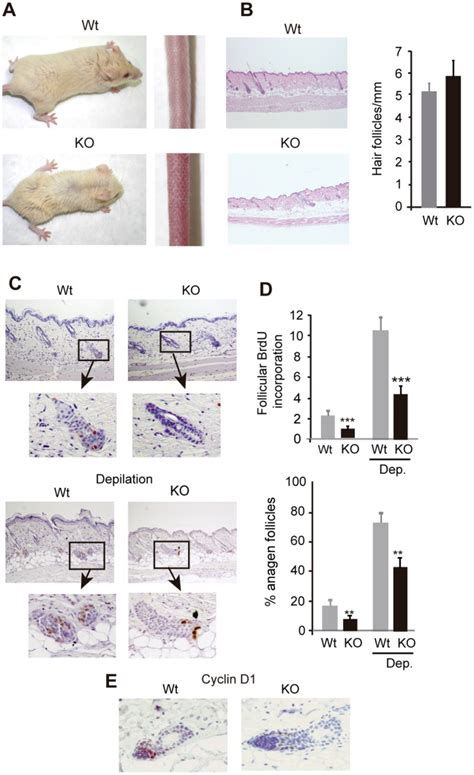 A Skin phenotype of wild type Wt and TRα1 TRβ KO mice B