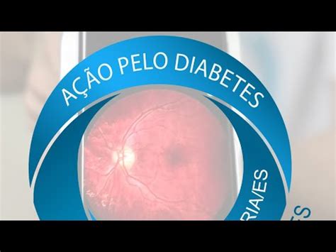 A O Pelo Diabetes Mutir O De Triagem Para Retinopatia Diab Tica