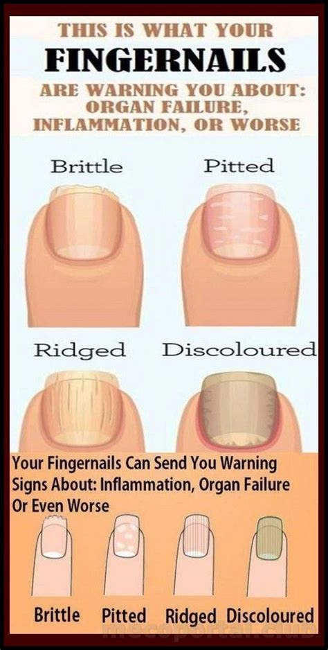 8 Important Signs Your Fingernails Can Tell About Your Health Artofit