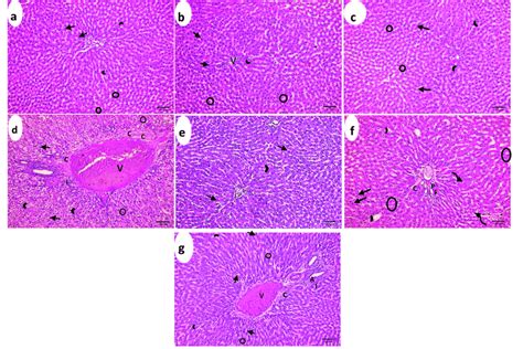 Effect Of Different Doses Of S Platensis Methanolic Extract On Albino