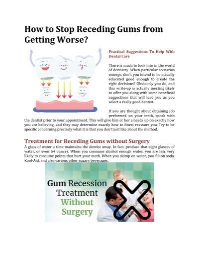 How to Treat Receding Gums without Surgery