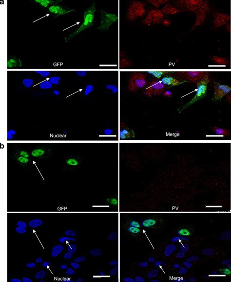 Confocal Microscopy Analysis Of PV In PV Infected Cells Transfected