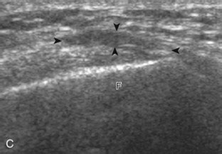 Knee Ultrasound | Clinical Gate