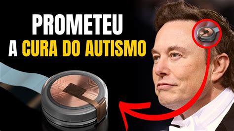 AUTISMO Chip cerebral Neuralink vai começar testes em humanos YouTube