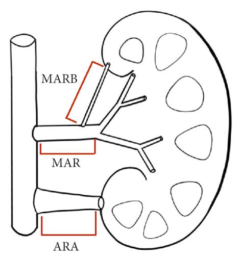 Naming Rules Of Renal Artery Main Renal Artery Branches Outside The Download Scientific