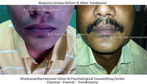 Vivekanantha Homeo Clinic And Psychological Counseling Centre Chennai