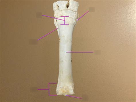 Metacarpus Dorsal Diagram Quizlet