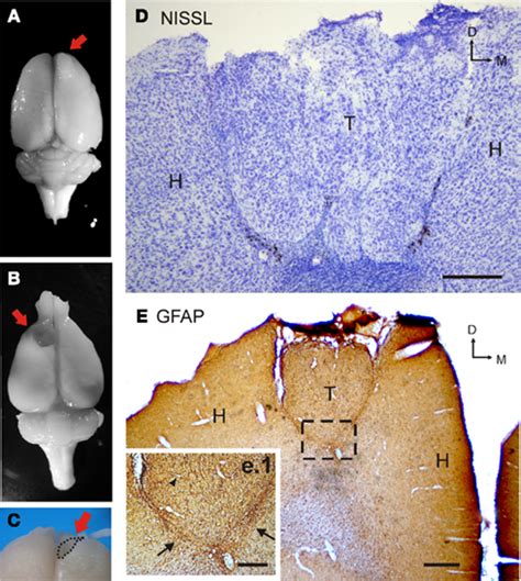 Frontiers Embryonic Amygdalar Transplants In Adult Rats With Motor