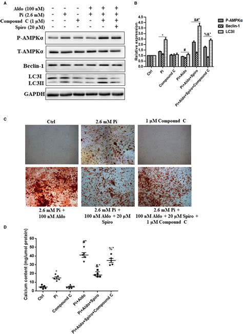 Aldosterone Enhances High Phosphate Induced Vascular Calcification