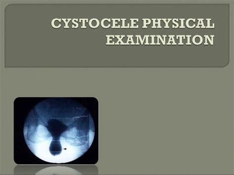 Cystocele physical examination