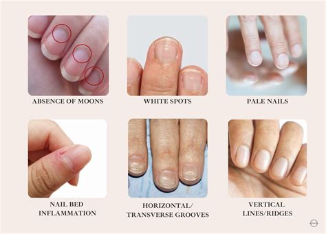 6 Signs Your Fingernails Are Trying To Tell You Something Organic