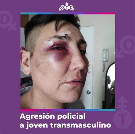 Asociación OTD Chile on Twitter RT Gata ykepaza