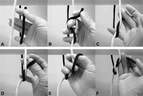 Modified Technique For One Handed Double Throw Surgical Tying Journal