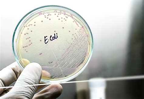 Viral Speed Superbug Shocks Scientists – Pure Living
