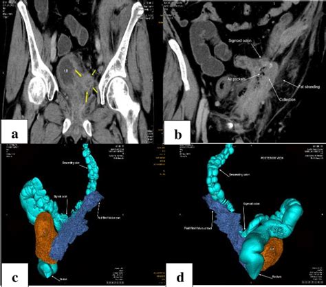 Ct Images Including 3d Reconstruction Showing Collection Which Is