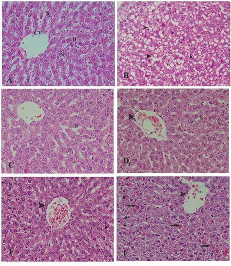 Aphotomicrograph Of Section Of Liver From Control Rats Showing Normal Download Scientific