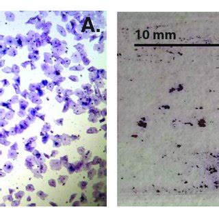 A Bright Field Micrograph X Total Magnification Showing Sample