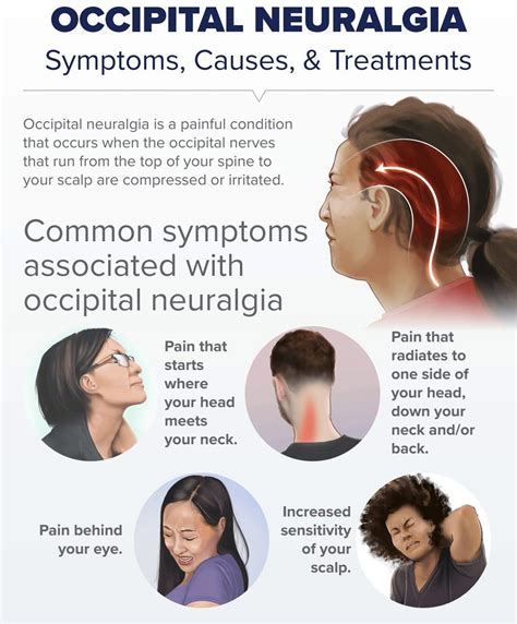 Injury - Neck and head pain - occipital neuralgia! The term ‘Occipital