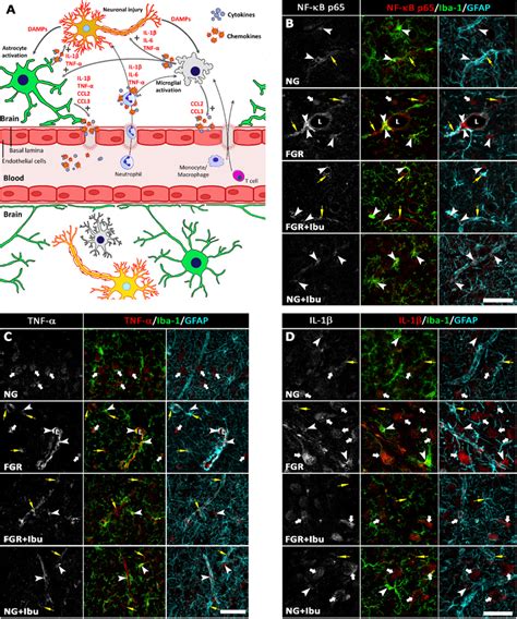 Increased Expression Of Pro Inflammatory Mediators At The Vasculature