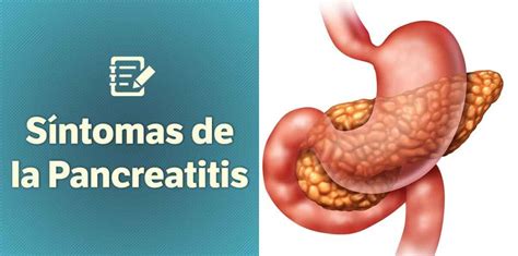 Pancreatitis síntomas Prevención y Tratamiento 2020