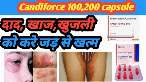 Candiforce 100 Candiforce 200 Candiforce 200 Uses In Hindi