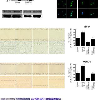 B Cells Promoted RCC Cell Migration And Invasion Through The Increase