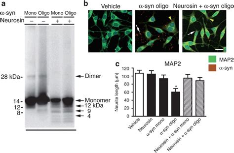 Neurosin Degradation Of Synuclein Syn Is Protective For Neuronal