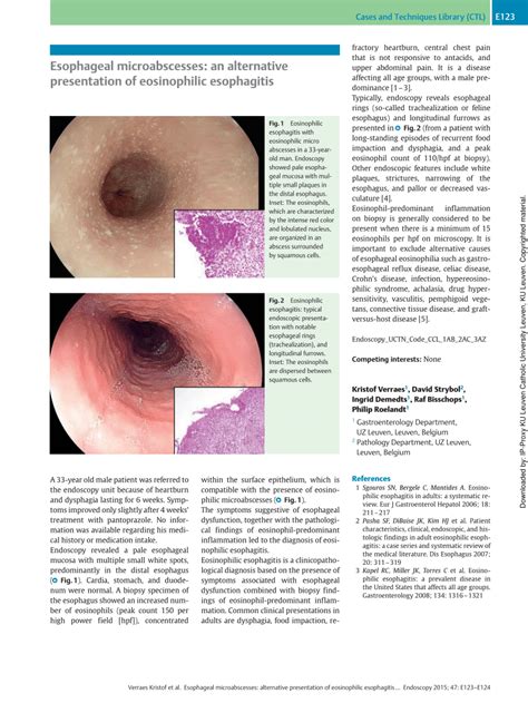 PDF Esophageal Microabscesses An Alternative Presentation Of