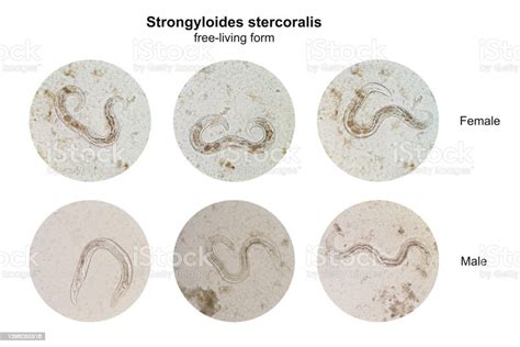 Strongyloides Stercoralis Male Vs Female